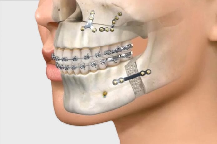 cirugia-maxilofacial-en-Costa-Rica-1