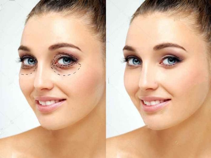 blefaroplastia A blefaroplastia é uma dessas técnicas de caráter reparador e auxilia no rejuvenescimento da face.